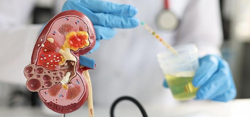 Böbrekleriniz Gerçekten Sağlıklı mı